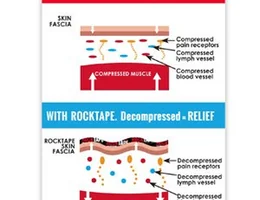 Restore Prehabilitation & Recovery®