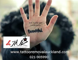 deINK Tattoo Removal