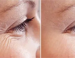 KM Microblading & Skin