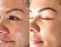 KM Microblading & Skin