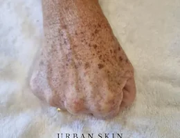 Urban Skin