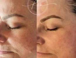 KM Microblading & Skin