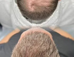 Hair Again - Hair Loss Solutions Clinic