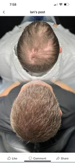 Photo Hair Again - Hair Loss Solutions Clinic