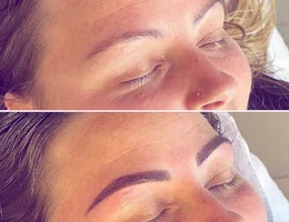 Brow Therapy