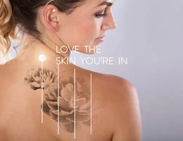 NZ Laser Tattoo Removal