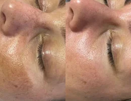 KM Microblading & Skin