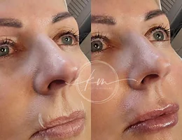 KM Microblading & Skin