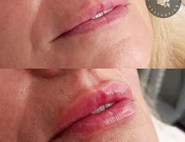 Avryl Kinnon Aesthetics • Injectables • laser • beauty