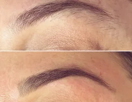 Brow Therapy